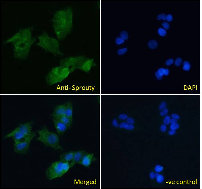 Goat Anti-Sprouty Antibody