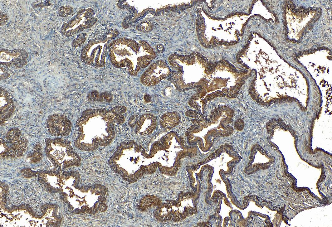 Goat Anti-SRD5A1 Antibody