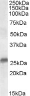 Goat Anti-SRD5A2 / 5-alpha reductase 2 Antibody