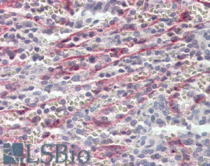 Goat Anti-Stabilin 1 Antibody