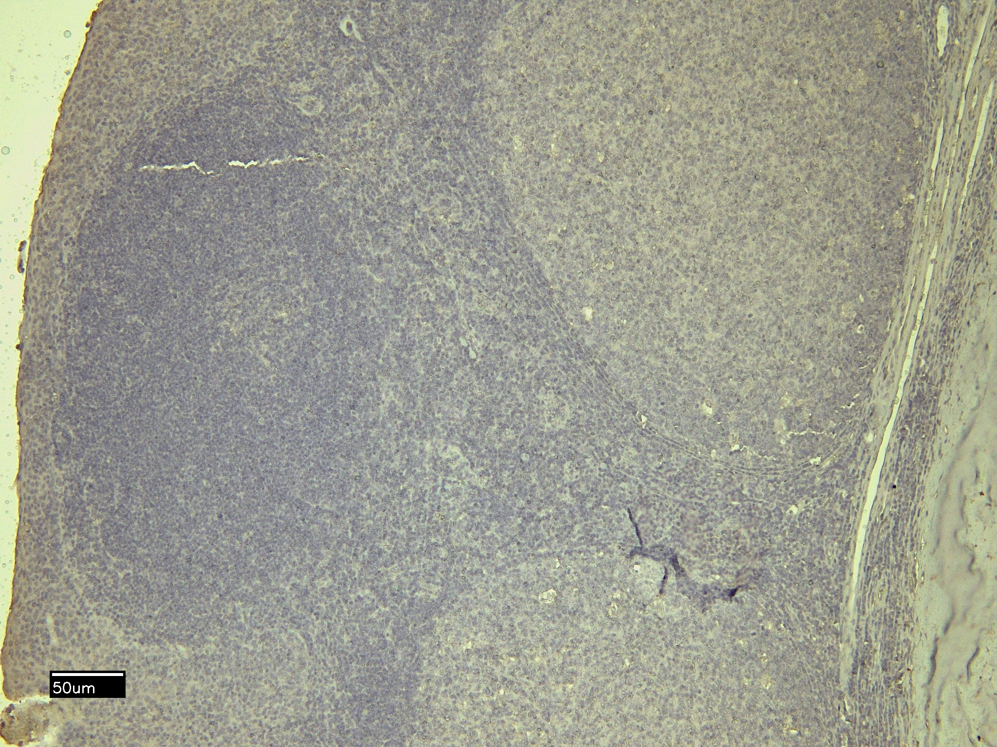 Goat Anti-STAT5A Antibody