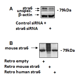 Goat Anti-STRA6 (mouse, rat) Antibody