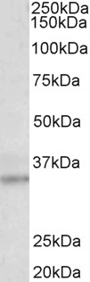 Goat Anti-STRA8 (aa186-198) Antibody