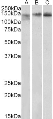 Goat Anti-Stromal antigen 2  / STAG2 Antibody