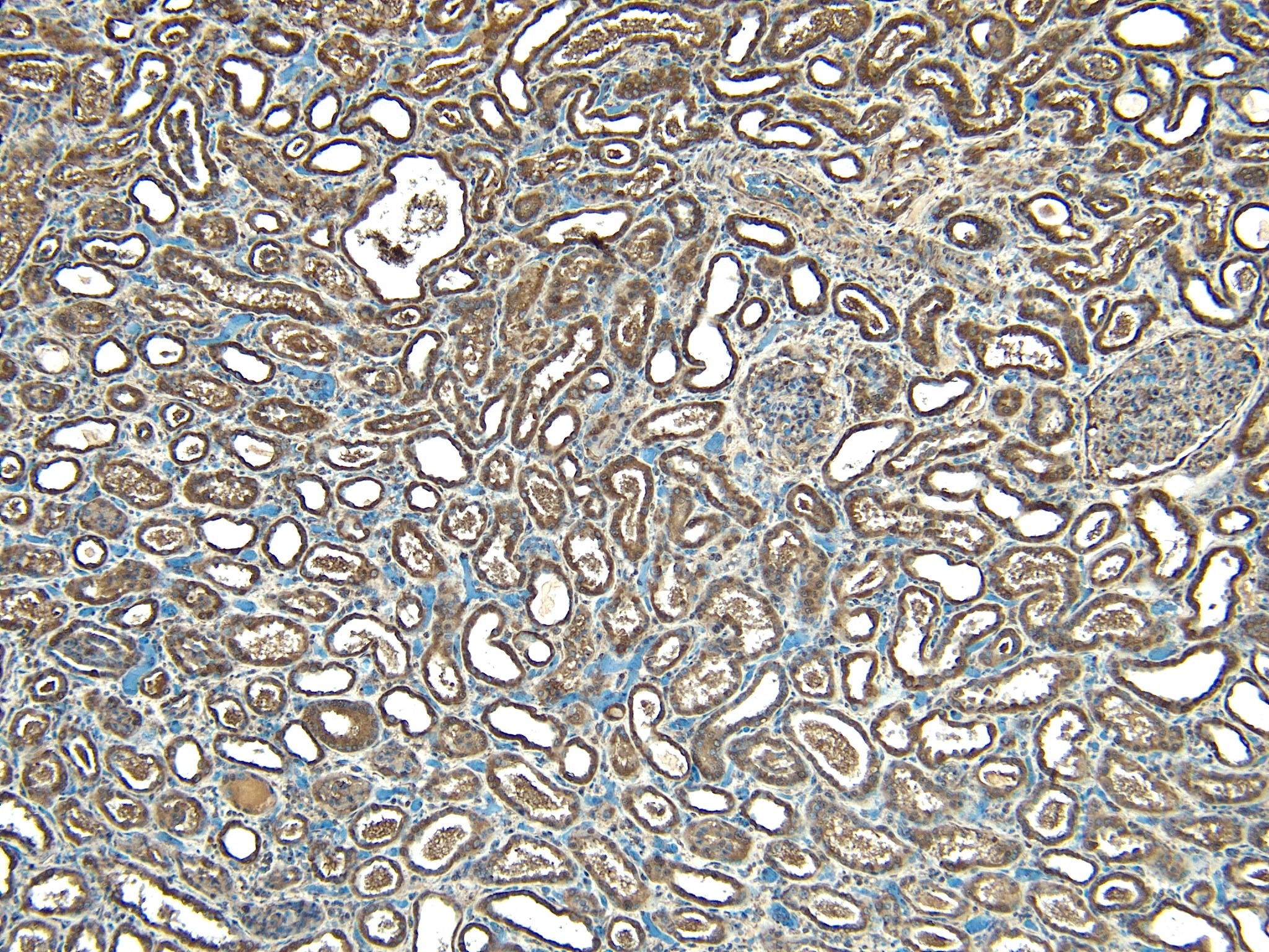 Goat Anti-STUB1 / CHIP Antibody
