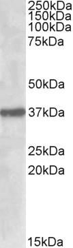 Goat Anti-SUMF1 Antibody