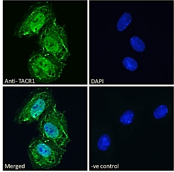 Goat Anti-TACR1 Antibody