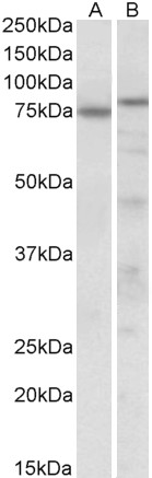 Goat Anti-TAp63alpha / deltaNp63alpha Antibody