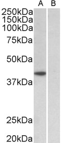 Goat Anti-TBP /Transcription factor IID (aa39-50) Antibody