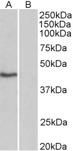 Goat Anti-TBP /Transcription factor IID (isoform1) Antibody
