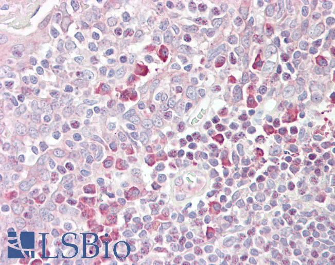 Goat Anti-TEB4 / MARCH-VI (aa 886 to 898) Antibody