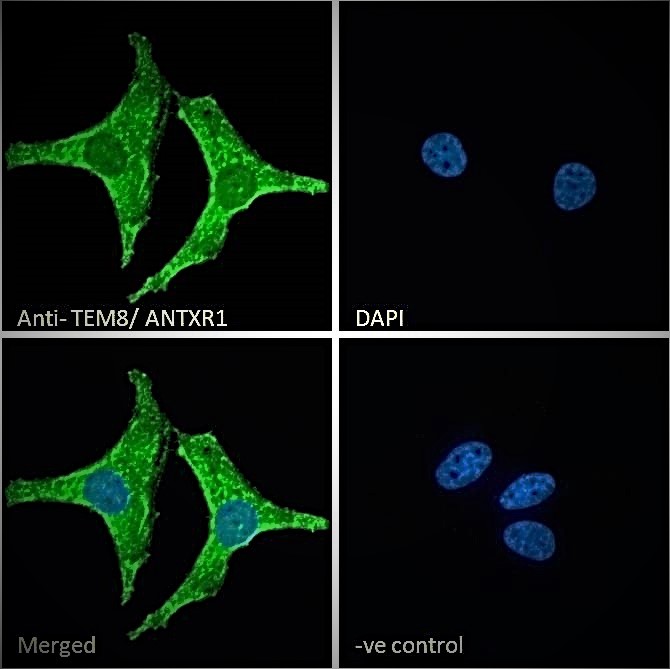 Goat Anti-TEM8 / Anthrax Toxin Receptor 1 Antibody