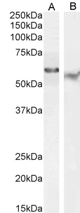 Goat Anti-TFEB (N Terminus) Antibody