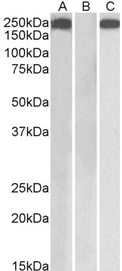 Goat Anti-Thrombospondin (internal) Antibody