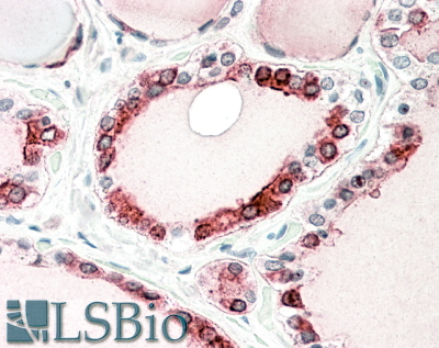 Goat Anti-thyroid peroxidase Antibody