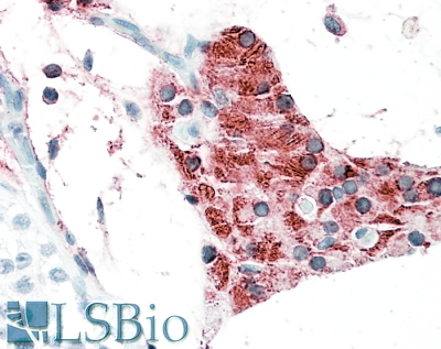 Goat Anti-TIAM2 Antibody