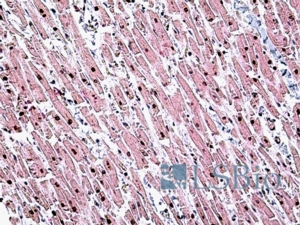 Goat Anti-TINF2 Antibody