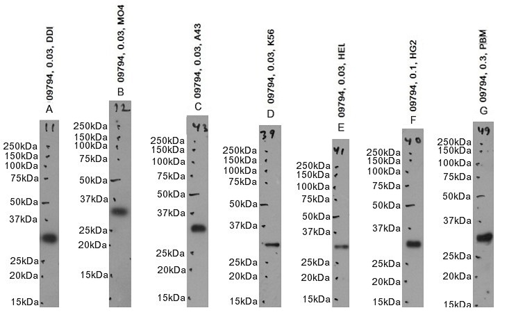 Goat Anti-TIPRL Antibody