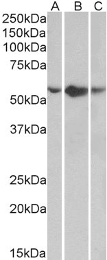 Goat Anti-TNFRSF1A / TNFR1 Antibody