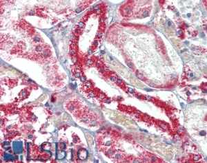 Goat Anti-TNFSF13 / APRIL Antibody