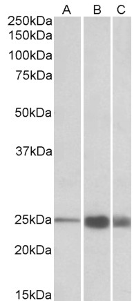Goat Anti-TNNI2 (aa83-95) Antibody