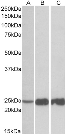 Goat Anti-TNNI2 Antibody