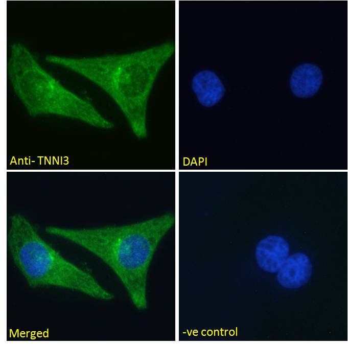 Goat Anti-TNNI3 (aa117-127) Antibody