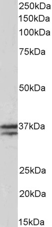 Goat Anti-TNNT1 Antibody