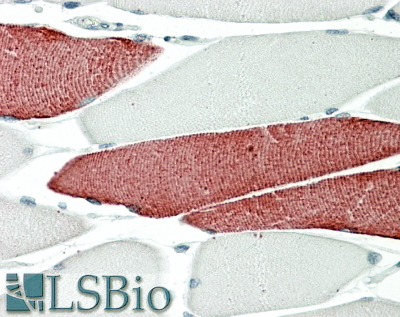 Goat Anti-TNNT3 Antibody