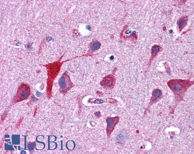 Goat Anti-TPD52L2 / D54 Antibody