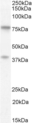 Goat Anti-TRABID / ZRANB1 Antibody