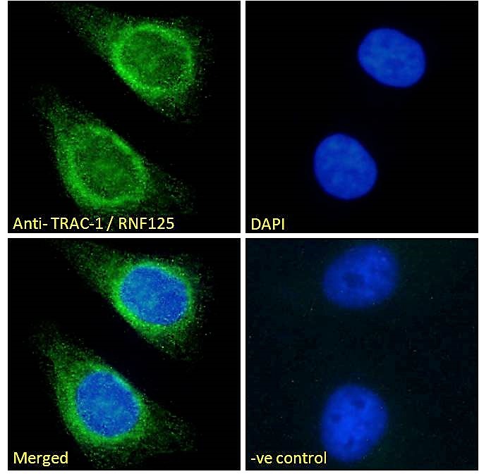 Goat Anti-TRAC-1 / RNF125 Antibody