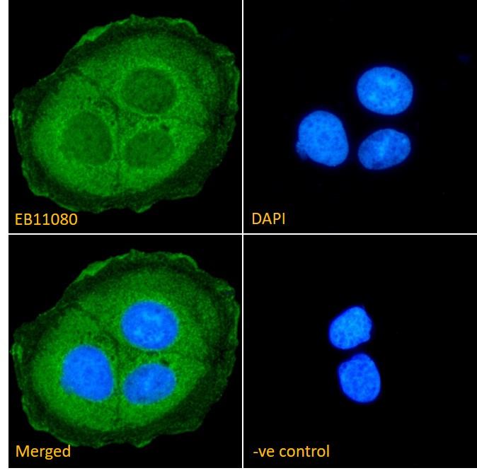 Goat Anti-Transglutaminase 2 (aa17-29) Antibody