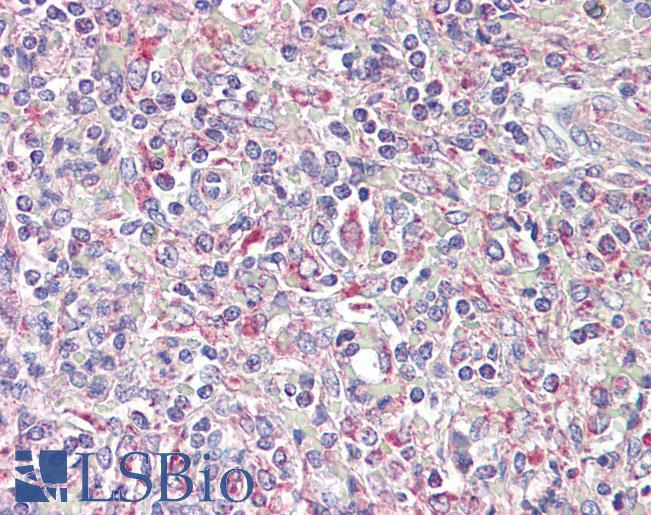 Goat Anti-TRIB1 Antibody