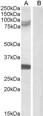 Goat Anti-TRIM2 Antibody
