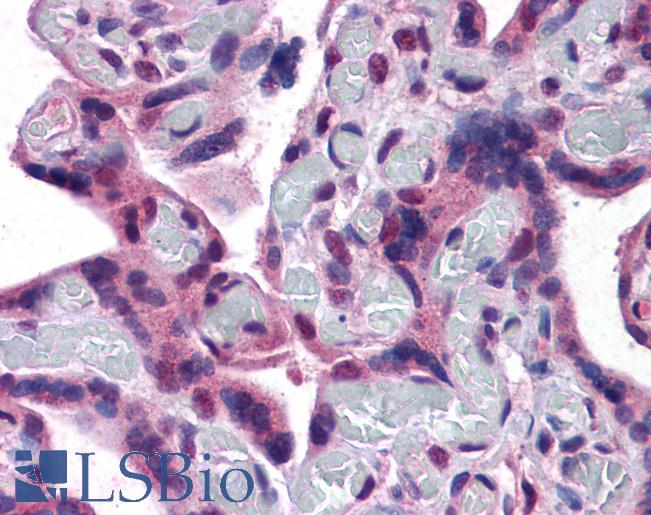 Goat Anti-TRPC4 Antibody