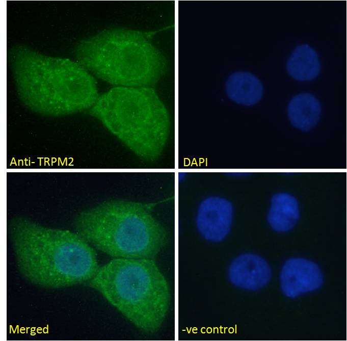 Goat Anti-TRPM2 Antibody
