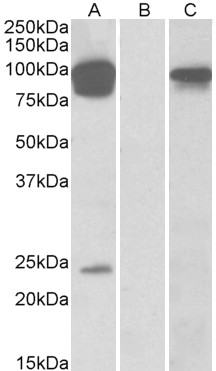 Goat Anti-TRPV3 (aa762-773) Antibody