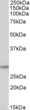 Goat Anti-TSHR (aa101-115) Antibody