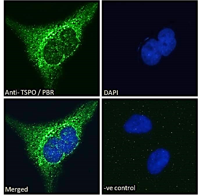 Goat Anti-TSPO / PBR (isoform) Antibody