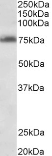 Goat Anti-TSPYL2 (aa441-454) Antibody