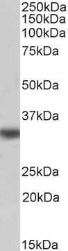 Goat Anti-TXNDC1 / TMX, biotinylated Antibody