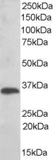 Goat Anti-TXNDC1 / TMX Antibody
