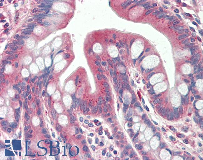 Goat Anti-TXNDC11 (aa113-126) Antibody