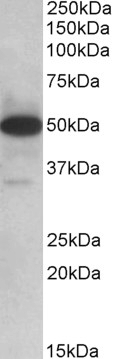 Goat Anti-TXNDC5 (aa281-295) Antibody