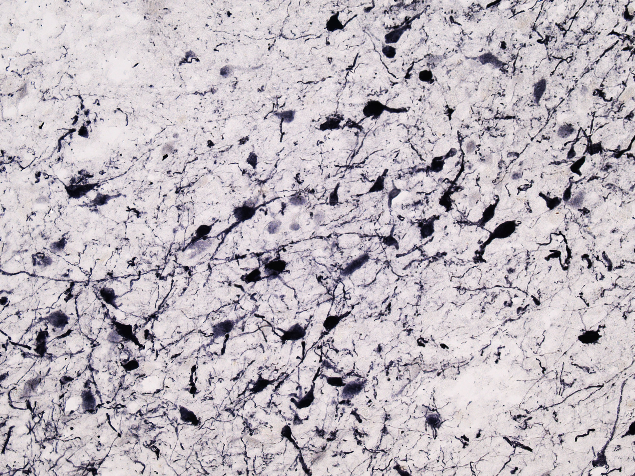 Goat Anti-Tyrosine Hydroxylase Antibody