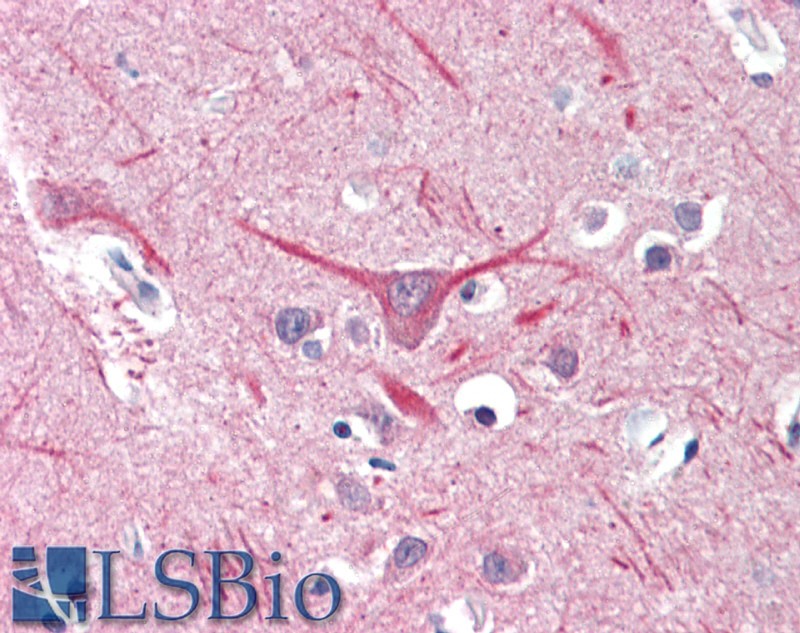 Goat Anti-UBR2 Antibody