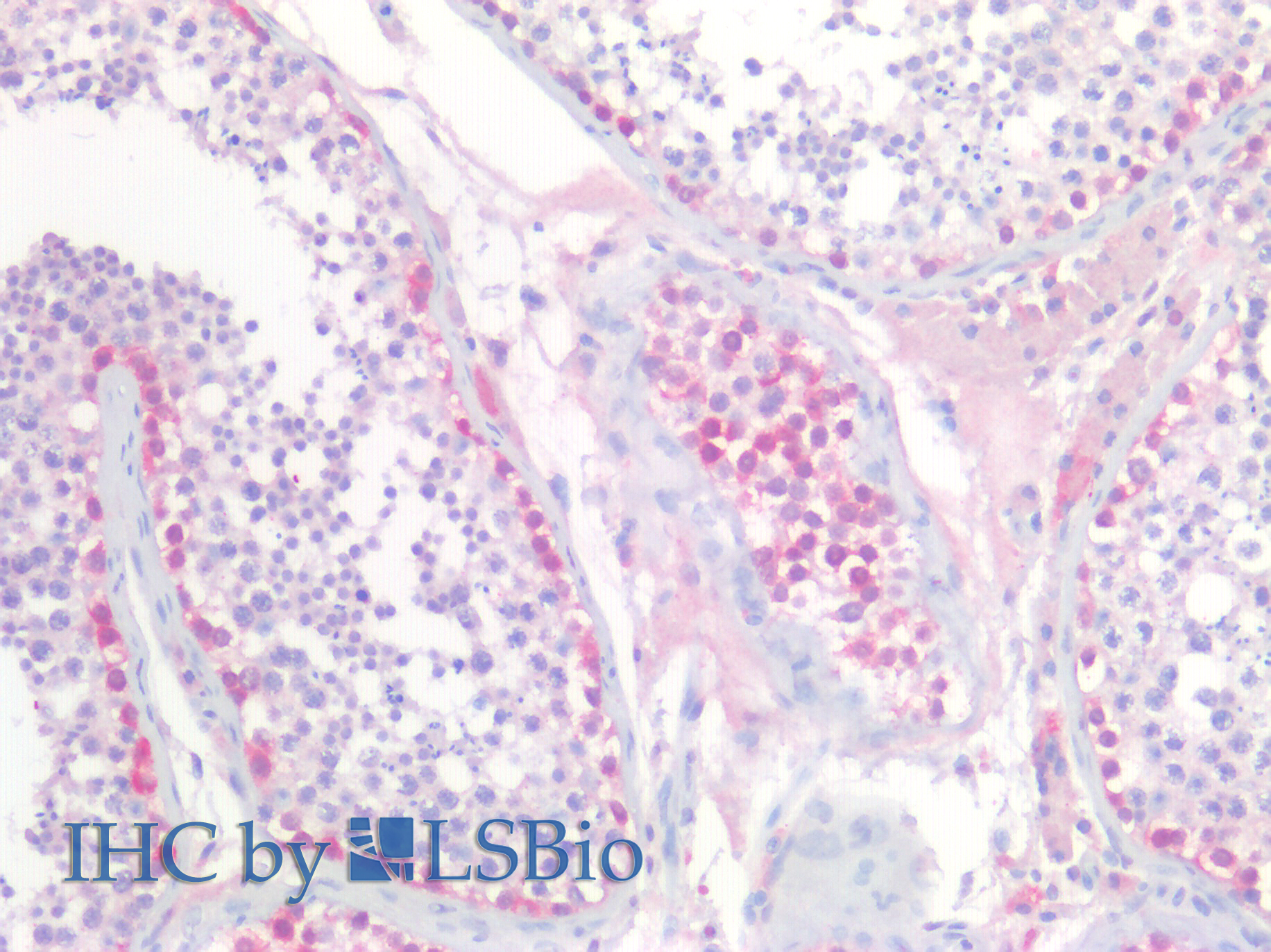 Goat Anti-UCHL1 (aa 211-221) Antibody