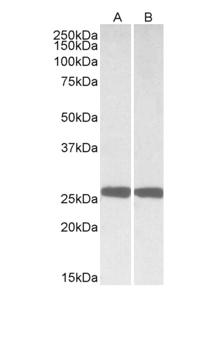 Goat Anti-UCHL1 (aa 58-68) Antibody