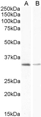 Goat Anti-UCP1 Antibody